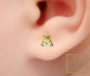 ARETE ORTOPEDICO OSO 5MM ALTO